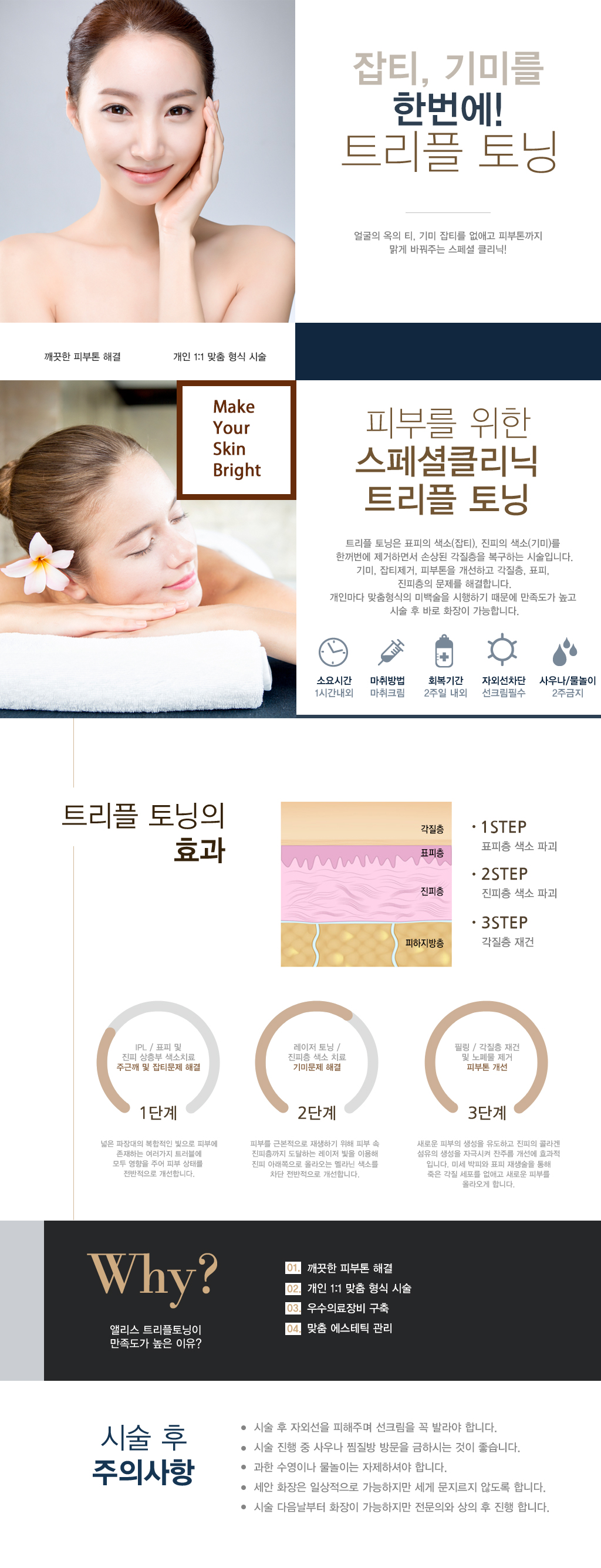 트리플토닝